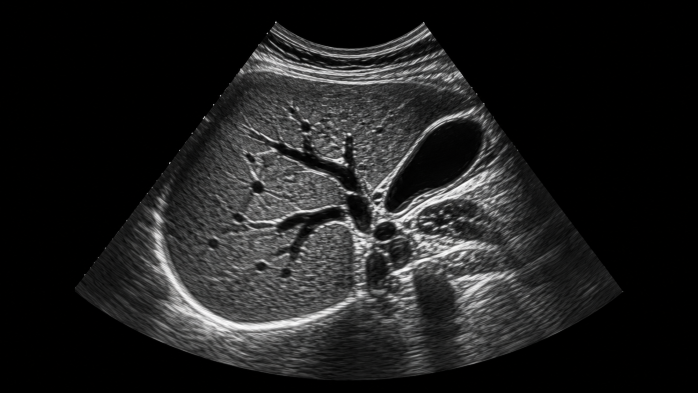Ultraschallbild Abdomen 