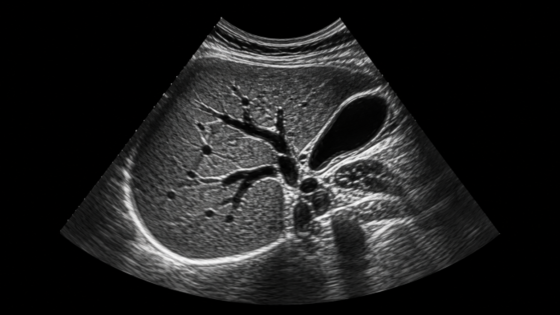 Ultraschallbild Abdomen 