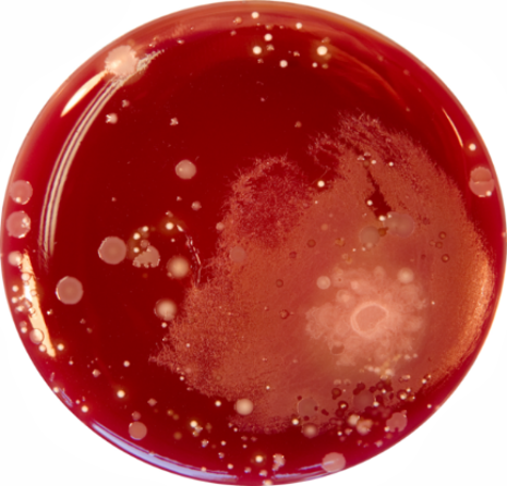 Wirksamkeit der Händehygiene - vorher